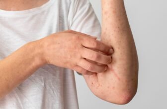 Skin-Related Symptoms