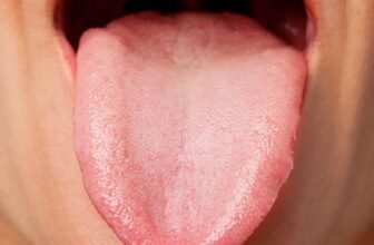 Tongue and Mouth-Related Signs