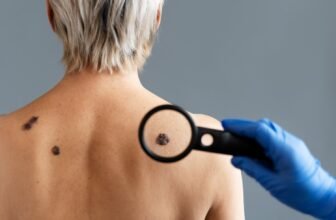 Skin Cancer Explained